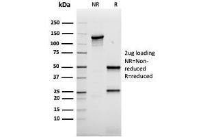 SDS-PAGE Analysis Purified AKT1 Recombinant Mouse Monoclonal Antibody (rAKT1/2491). (Recombinant AKT1 抗体  (AA 85-189))