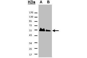 Western Blotting (WB) image for anti-HAUS Augmin-Like Complex, Subunit 8 (HAUS8) antibody (ABIN2854852)