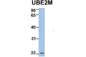 Host:  Rabbit  Target Name:  UBE2M  Sample Type:  Human 721_B  Antibody Dilution:  1. (UBE2M 抗体  (N-Term))