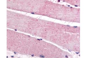 Anti-BEST3 antibody IHC of human skeletal muscle. (Bestrophin 3 抗体  (C-Term))