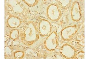 Immunohistochemistry of paraffin-embedded human kidney tissue using ABIN7170015 at dilution of 1:100 (SLC5A2 抗体  (AA 335-422))