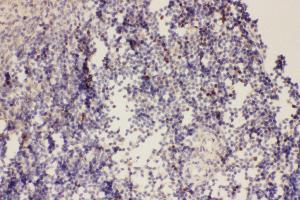 Anti-FOXP3 Picoband antibody,  IHC(P):Rat Spleen Tissue (FOXP3 抗体  (AA 101-431))