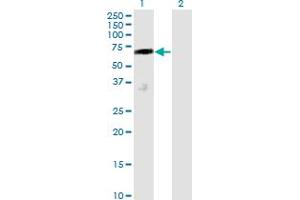 Western Blot analysis of DCP1A expression in transfected 293T cell line by DCP1A monoclonal antibody (M01), clone 2D12. (DCP1A 抗体  (AA 186-285))