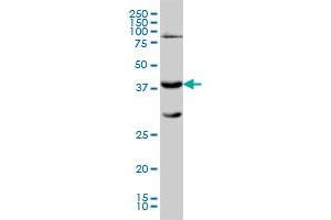 Western Blotting (WB) image for anti-Galactose-1-Phosphate Uridylyltransferase (GALT) (AA 1-379) antibody (ABIN560995)