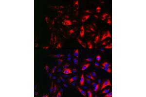 Immunofluorescence analysis of U2OS cells using RRM2 Rabbit pAb (ABIN6129715, ABIN6147265, ABIN6147266 and ABIN6220890) at dilution of 1:150 (40x lens). (RRM2 抗体  (AA 1-389))