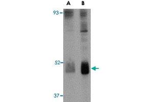 Western blot analysis of WNT10B in human skeletal muscle tissue lysate with WNT10B polyclonal antibody  at (A) 2 and (B) 4 ug/mL . (WNT10B 抗体  (Internal Region))