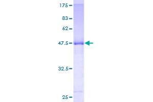 IPP Isomerase 2 Protein (IDI2) (AA 1-227) (GST tag)