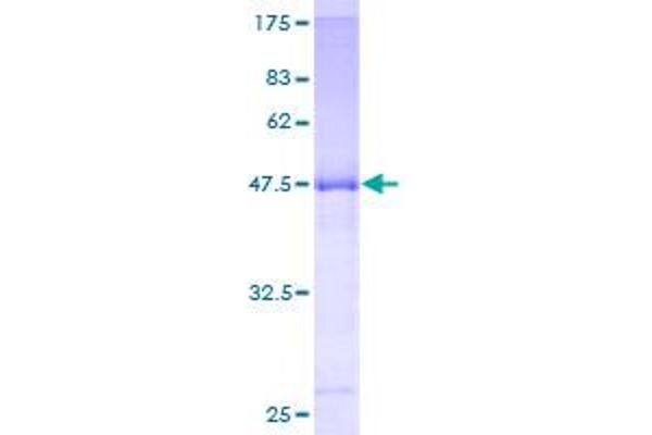 IPP Isomerase 2 Protein (IDI2) (AA 1-227) (GST tag)