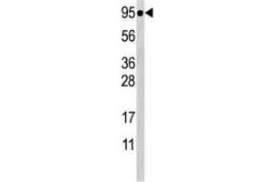 Western Blotting (WB) image for anti-Signal Transducer and Activator of Transcription 5A (STAT5A) (pSer726) antibody (ABIN5021402) (STAT5A 抗体  (pSer726))
