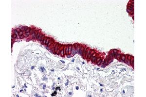 Anti-SCO2 antibody IHC of human lung, respiratory epithelium. (SCO2 抗体  (C-Term))