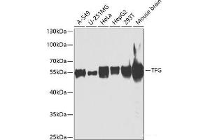 Western blot analysis of extracts of various cell lines using TFG Polyclonal Antibody at dilution of 1:1000. (TFG 抗体)