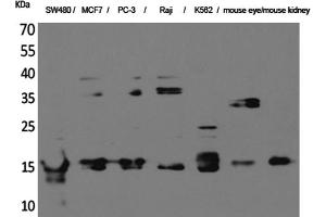 Western Blotting (WB) image for anti-MK (Internal Region) antibody (ABIN5956379) (MK (Internal Region) 抗体)