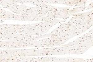 Immunohistochemistry (Paraffin-embedded Sections) (IHC (p)) image for anti-Acidic (Leucine-Rich) Nuclear phosphoprotein 32 Family, Member B (ANP32B) antibody (ABIN7072887)