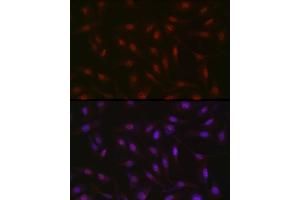 Immunofluorescence analysis of U2OS cells using RBM14 Rabbit pAb (ABIN6133649, ABIN6146760, ABIN6146762 and ABIN6217049) at dilution of 1:350 (40x lens). (RBM14 抗体  (AA 500-600))