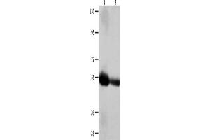 Gel: 10 % SDS-PAGE, Lysate: 60 μg, Lane 1-2: Human liver cancer tissue, Human bladder carcinoma tissue, Primary antibody: ABIN7128892(CEACAM1 Antibody) at dilution 1/400, Secondary antibody: Goat anti rabbit IgG at 1/8000 dilution, Exposure time: 2 minutes (CEACAM1 抗体)