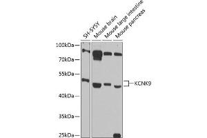 Western blot analysis of extracts of various cell lines, using KCNK9 antibody (ABIN6128568, ABIN6142756, ABIN6142758 and ABIN6216267) at 1:1000 dilution. (KCNK9 抗体  (AA 265-374))