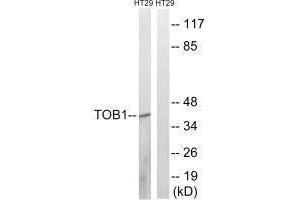 Western blot analysis of extracts from HT-29 cells, treated with serum (20 % , 15 mins), using TOB1 (Ab-164) antibody. (Protein Tob1 (TOB1) (Ser164) 抗体)