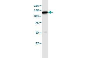 Immunoprecipitation of HK1 transfected lysate using anti-HK1 MaxPab rabbit polyclonal antibody and Protein A Magnetic Bead , and immunoblotted with HK1 purified MaxPab mouse polyclonal antibody (B01P) . (Hexokinase 1 抗体  (AA 1-916))