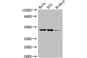 Western Blot Positive WB detected in: Hela whole cell lysate, PC-3 whole cell lysate, Mouse kidney tissue All lanes: GSK3B antibody at 3 μg/mL Secondary Goat polyclonal to rabbit IgG at 1/50000 dilution Predicted band size: 47, 49 kDa Observed band size: 47 kDa (GSK3 beta 抗体  (AA 1-420))