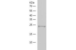 Western Blotting (WB) image for RAB5B, Member RAS Oncogene Family (RAB5B) (AA 1-215) protein (His tag) (ABIN7124760) (RAB5B Protein (AA 1-215) (His tag))