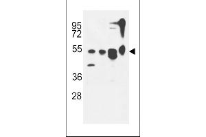 ATG13 Antibody (N-term) (ABIN653882 and ABIN2843129) western blot analysis in MDA-M,CEM,T47D cell line and mouse cerebellum tissue lysates (35 μg/lane). (ATG13 抗体  (N-Term))