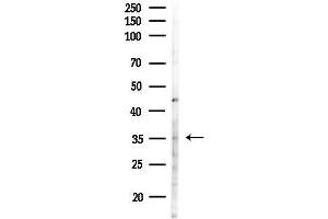 anti-Heterogeneous Nuclear Ribonucleoprotein H3 (2H9) (HNRNPH3) (C-Term) antibody