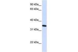 Image no. 1 for anti-Reticulon 1 (RTN1) (AA 36-85) antibody (ABIN6741062) (Reticulon 1 抗体  (AA 36-85))