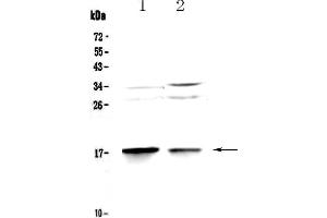 Western blot analysis of MAP1LC3A using anti-MAP1LC3A antibody .
