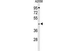 Western blot analysis of GPSN2 (arrow) in A2058 cell line lysates (35ug/lane) using TECR / GPSN2  (TECR 抗体  (C-Term))