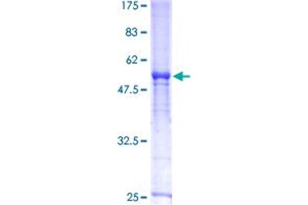 DCK Protein (AA 1-260) (GST tag)