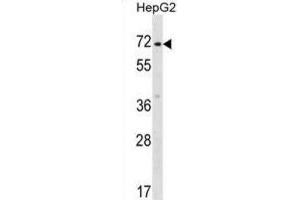 Western Blotting (WB) image for anti-Zinc Finger Protein 155 (ZNF155) antibody (ABIN2999111)