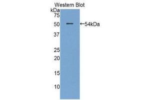 Western Blotting (WB) image for anti-Plasminogen Activator, Urokinase Receptor (PLAUR) (AA 15-211) antibody (FITC) (ABIN1860909) (PLAUR 抗体  (AA 15-211) (FITC))