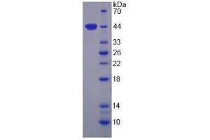 SDS-PAGE analysis of Human Arginase II Protein. (ARG2 蛋白)