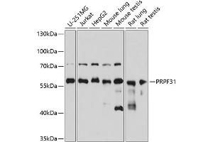 Western blot analysis of extracts of various cell lines, using PRPF31 antibody (ABIN6132996, ABIN6146262, ABIN6146264 and ABIN6221399) at 1:3000 dilution. (PRPF31 抗体  (AA 1-200))