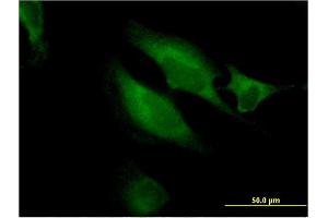 Immunofluorescence of monoclonal antibody to RAB9B on HeLa cell. (RAB9B 抗体  (AA 102-201))
