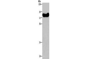 Gel: 8 % SDS-PAGE, Lysate: 40 μg, Lane: HepG2 cells, Primary antibody: ABIN7129183(DDX43 Antibody) at dilution 1/200, Secondary antibody: Goat anti rabbit IgG at 1/8000 dilution, Exposure time: 1 minute (DDX43 抗体)