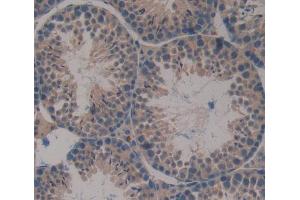 Used in DAB staining on fromalin fixed paraffin- embedded Kidney tissue (NUP37 抗体  (AA 87-324))