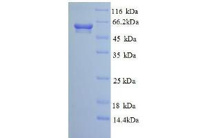 SDS-PAGE (SDS) image for Calcium Activated Nucleotidase 1 (CANT1) (AA 80-397), (partial) protein (GST tag) (ABIN1047658)