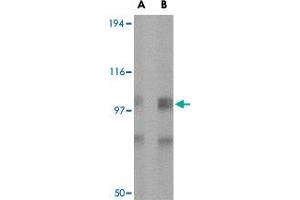 Western blot analysis of GRIK1 in rat brain tissue lysate with GRIK1 polyclonal antibody  at (A) 0. (GRIK1 抗体  (Internal Region))
