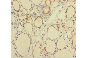 Immunohistochemistry of paraffin-embedded human thyroid tissue using ABIN7172031 at dilution of 1:100 (TXNL1 抗体  (AA 2-289))