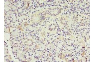 Immunohistochemistry of paraffin-embedded human pancreatic tissue using ABIN7159589 at dilution of 1:100 (MTRR 抗体  (AA 1-725))
