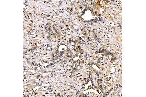 IHC analysis of Alpha 2 Antiplasmin/SERPINF2 using anti-Alpha 2 Antiplasmin/SERPINF2 antibody (ABIN7601808). (alpha 2 Antiplasmin 抗体  (AA 461-491))