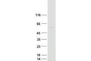 Western Blotting (WB) image for ARP3 Actin-Related Protein 3 (ACTR3) protein (Myc-DYKDDDDK Tag) (ABIN2714373)