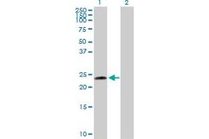 Western Blot analysis of UBE2T expression in transfected 293T cell line by UBE2T MaxPab polyclonal antibody. (Ube2t 抗体  (AA 1-197))
