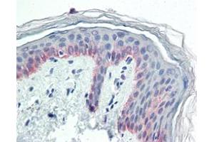Immunohistochemical analysis of paraffin-embedded human skin tissues using CK5 mouse mAb. (Cytokeratin 5 抗体)