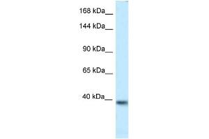 WB Suggested Anti-Kcnq2 Antibody   Titration: 1. (KCNQ2 抗体  (Middle Region))