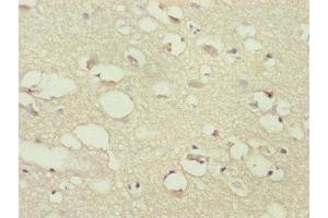 Immunohistochemistry of paraffin-embedded human brain tissue using ABIN7169284 at dilution of 1:100 (PPP2R3C 抗体  (Regulatory Subunit B))