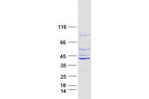Western Blotting (WB) image for Leucine Rich Repeat Containing 39 (LRRC39) protein (Myc-DYKDDDDK Tag) (ABIN2724914)