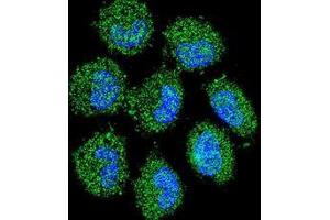 Confocal immunofluorescent analysis of PRAMEF6 Antibody (C-term)(Cat#AP53435PU-N) with NCI-H460 cell followed by Alexa Fluor 488-conjugated goat anti-rabbit lgG (green). (PRAMEF6 抗体  (C-Term))
