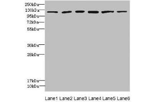 Western blot All lanes: UBE4A antibody at 2. (UBE4A 抗体  (AA 797-1066))